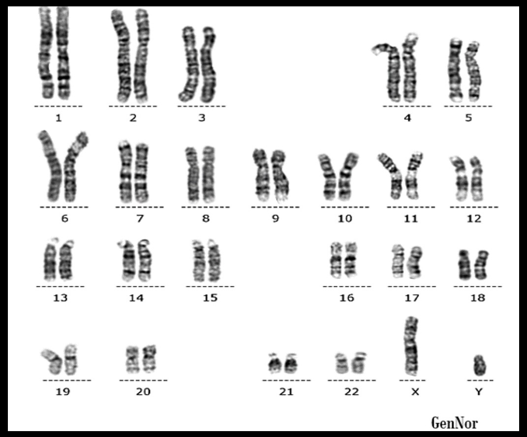 Gennor cariotipo